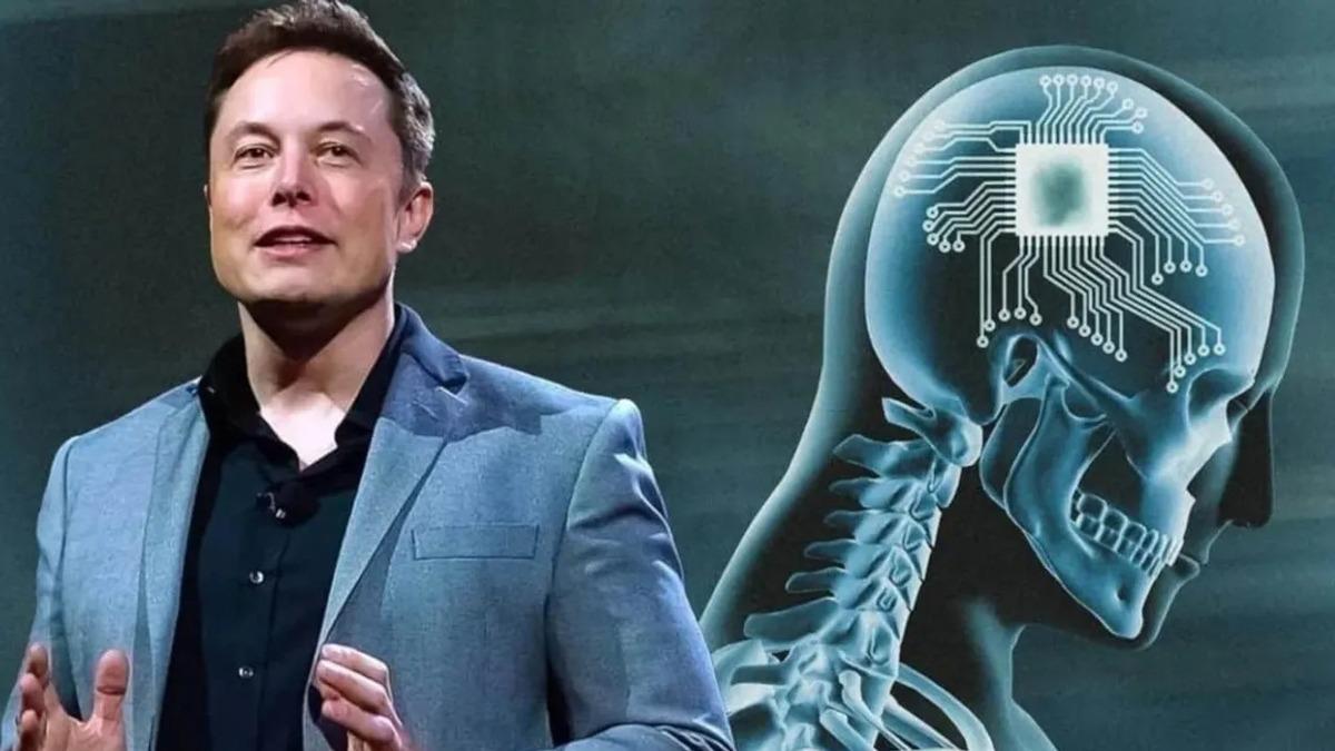Felli insanlara beyin ipi! Elon Musk'n klinik deneyi balyor