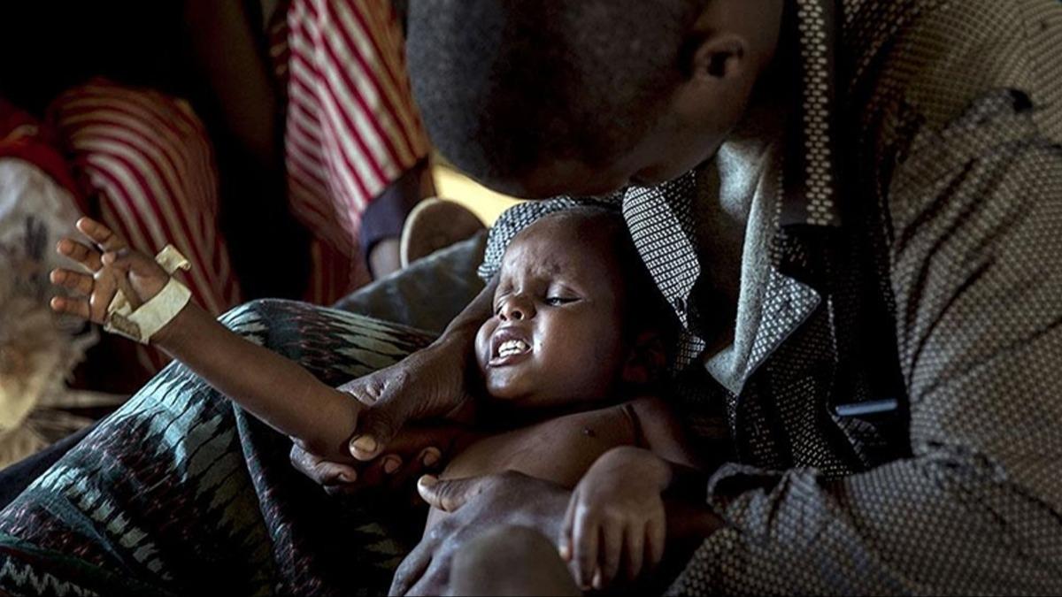 Zimbabve'de kolera can almaya devam ediyor! lenlerin says 100' at