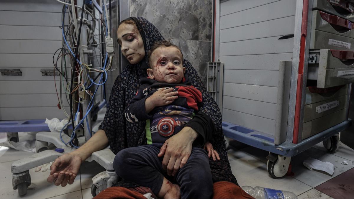 Slovenya'dan Gazze'deki hastane katliamna tepki: Sivillerin ldrlmesi hakl gsterilemez