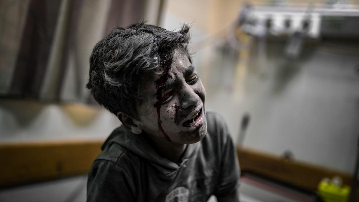 Mslman aratrmaclardan dnyaya ar: Gazze iin acil eyleme gein