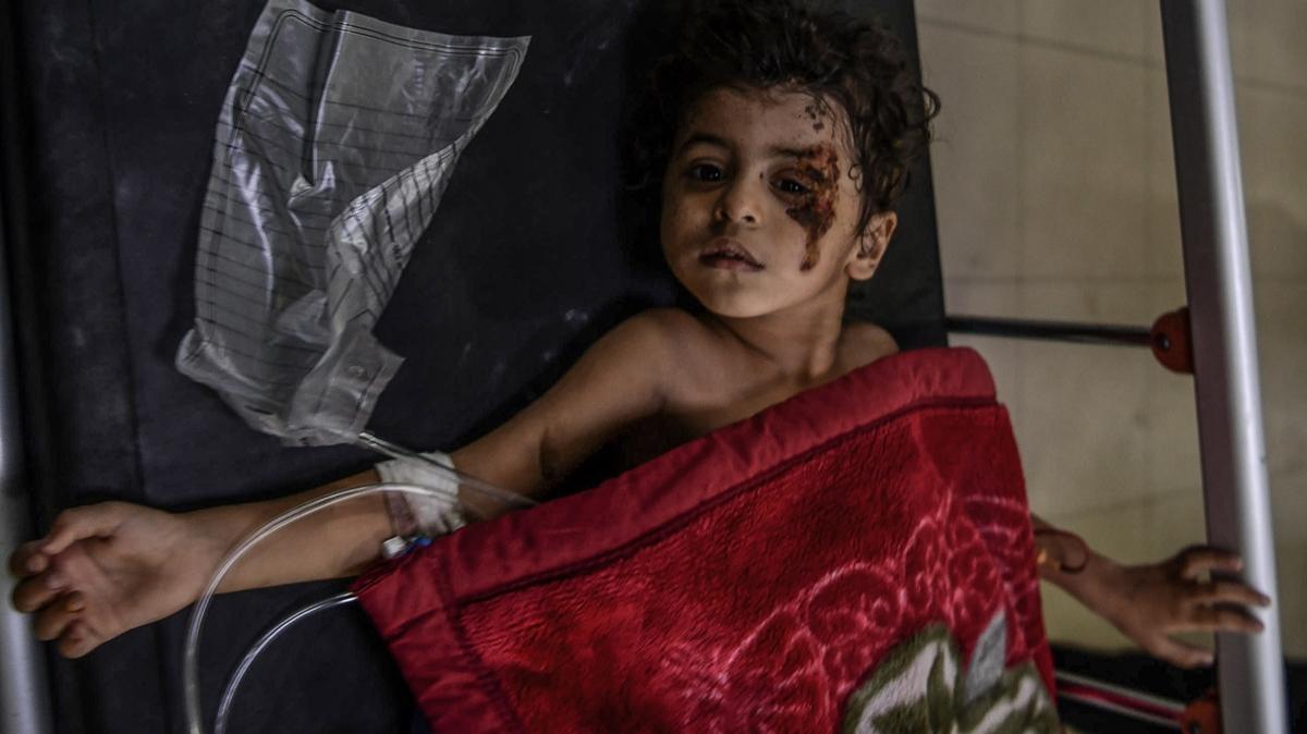 İsrail'in hastane katliamları sebebiyle Gazze'deki yaralılar yerlerinden edildi