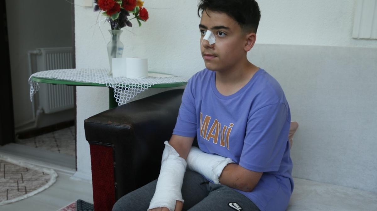 Bir sahipsiz kpek saldrs daha! 13 yandaki ocuk deheti yaad