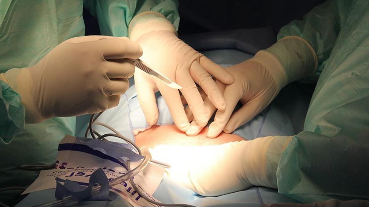 Organ ba yapt 4 hastaya umut oldu