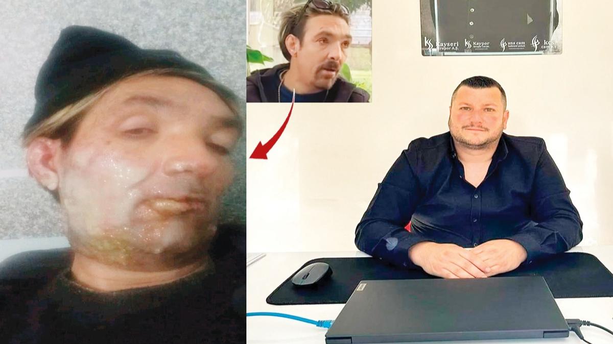 Seferihisar Belediyesi'nde insanlk d olay! TikTok'taki akm engelli personele denediler