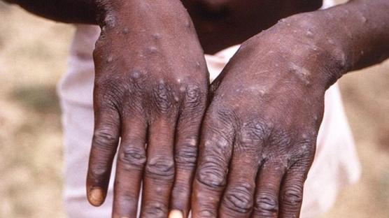 Afrika lkesinde M iei vakas! 4 kiide grld