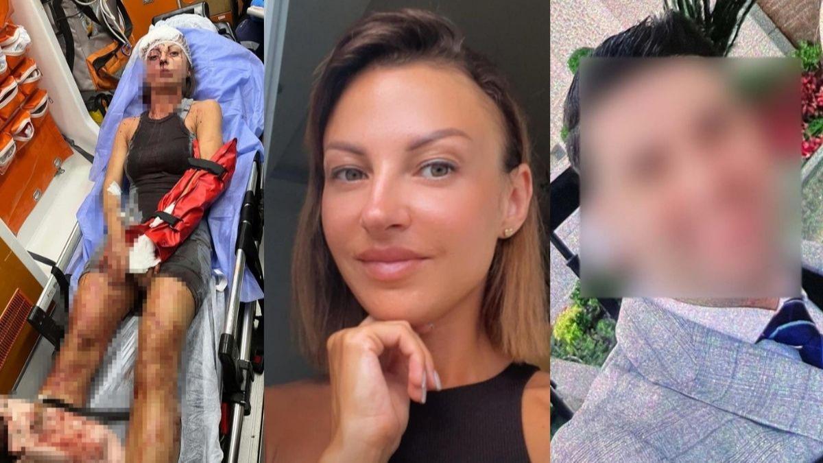 Sopayla saldrd, kafasna zmba atld! Antalya'da e deheti