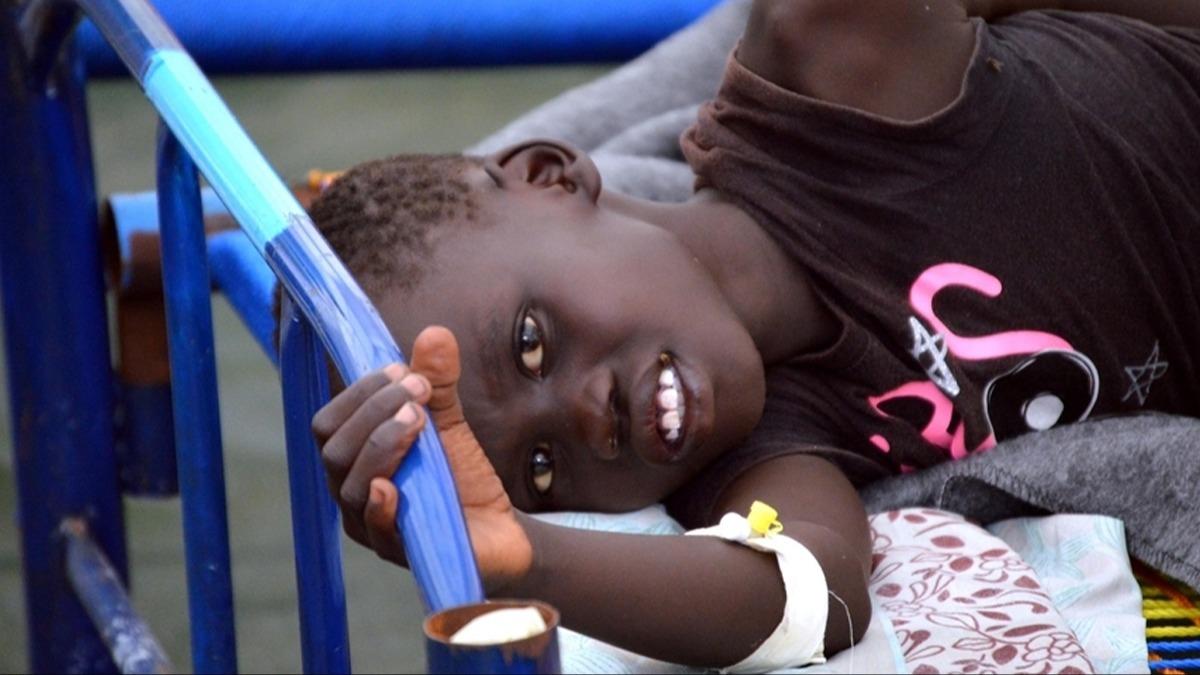 Sudan'da bir haftada 2 bin 627 yeni kolera vakas kaydedildi