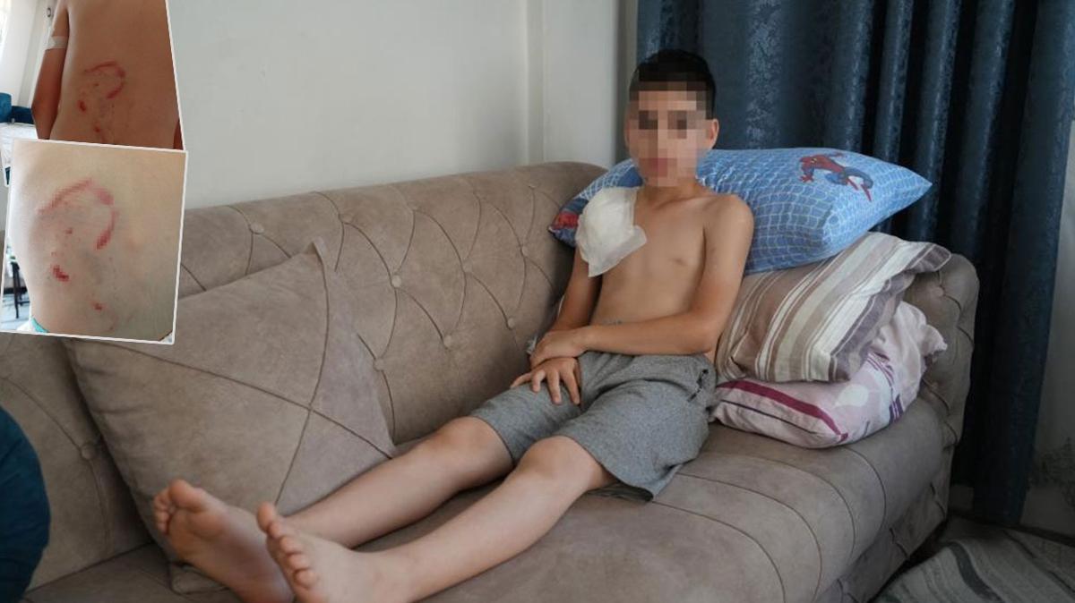 Samsun'da sahipli kpek deheti: Sol kolu fel kald, hayat kabusa dnd