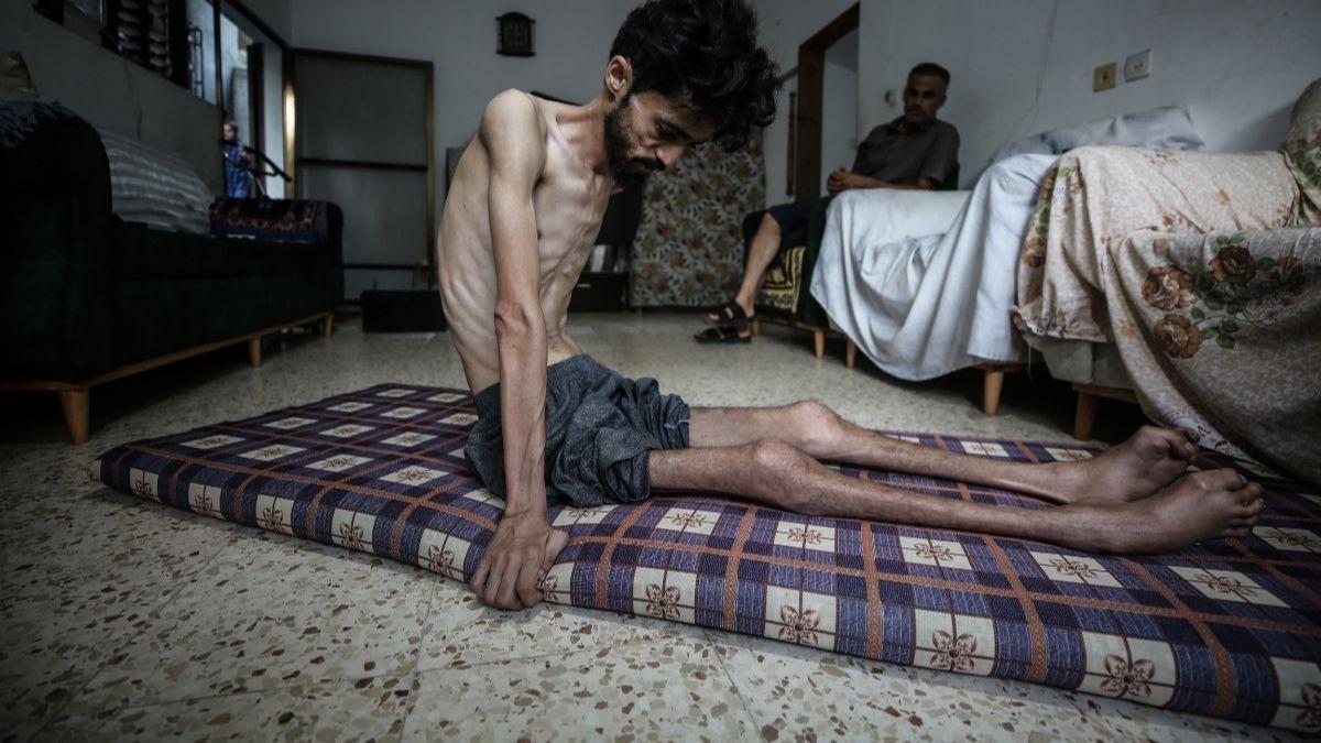 Gazze'de abluka can almaya devam ediyor: 117'si ocuk, 303 kii alktan hayatn kaybetti