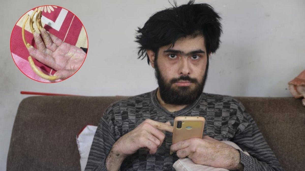 23 yandaki gen hayatn ekrana hapsetti! 3 yldr evden kmyor