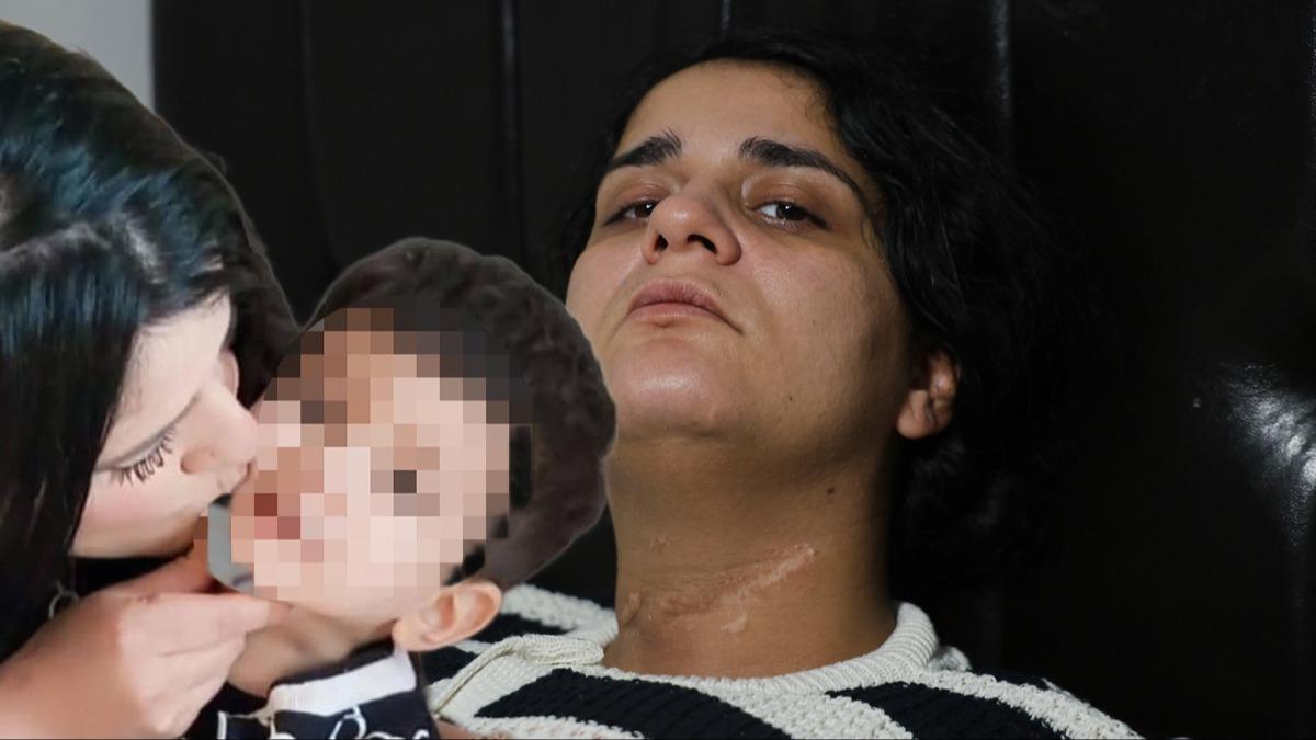 Boaz kesildi, engelli kald! Dehet anlarn ilk kez anlatt 