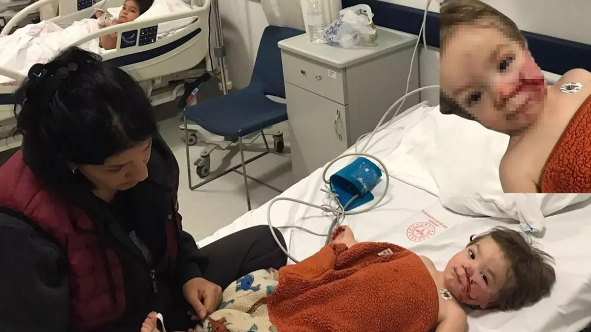 Bakentte 2 ocuu yaralayan pitbull cinsi kpein sahibi tutukland