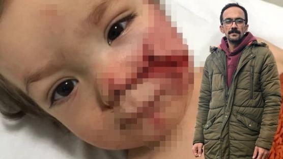 Pitbull dehşetini yaşayan baba: Bu kadın çıkarsa biz bir daha rahat uyuyamayız