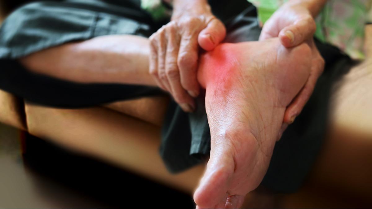 Bilim insanlar gut hastalnn asl sebebini buldu; Sonular artc