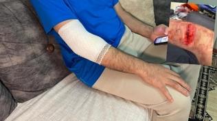 Bir köpek saldırısı daha! Sitede dolaştırılırken güvenlikçiyi ısırdı