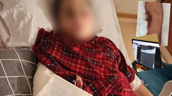 lkokulda dehet! 9 yandaki ocuk arkadann kolunu iki yerinden krd