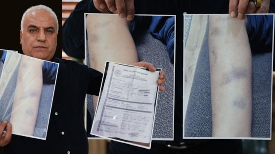 �zel okulda darp skandal�! Soru�turma ba�lat�ld�