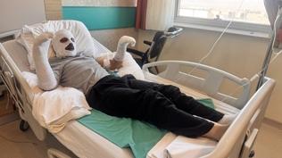 �ay demlemek isterken kabusu ya�ad�! V�cudunun d�rtte biri yand�