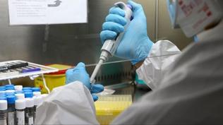 Bilim insanlar� Alzheimer'�n n�rolojik hasar�n� tersine �evirmeyi ba�ard�