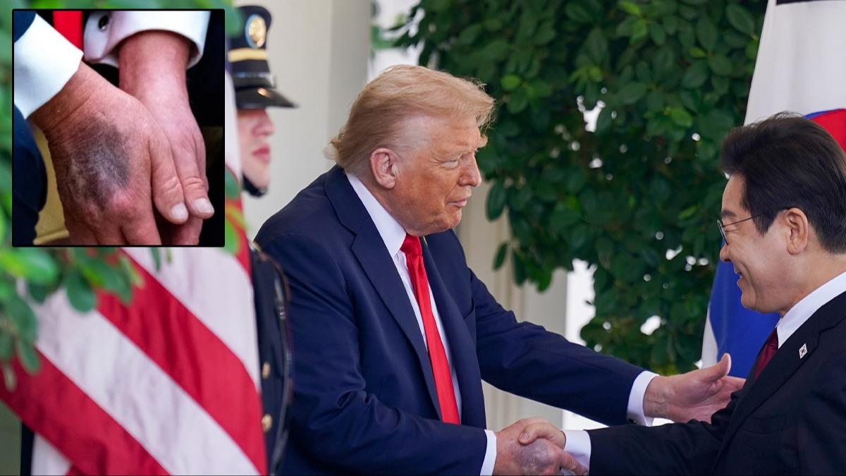 Trump'�n elindeki morluklar�n sebebi belli oldu: Kalbimden ince, g�zel kan�n akmas�n� istiyorum