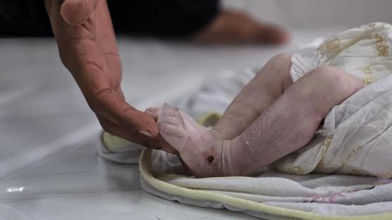 Gazze'de insanl�k donuyor: 7 g�nl�k bebek so�u�a dayanamad�