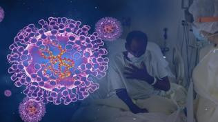 M �i�e�i vir�s� Gana'y� zorluyor: Can kayb� y�kseldi