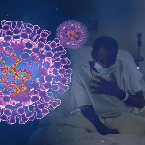 M �i�e�i vir�s� Gana'y� zorluyor: Can kayb� y�kseldi