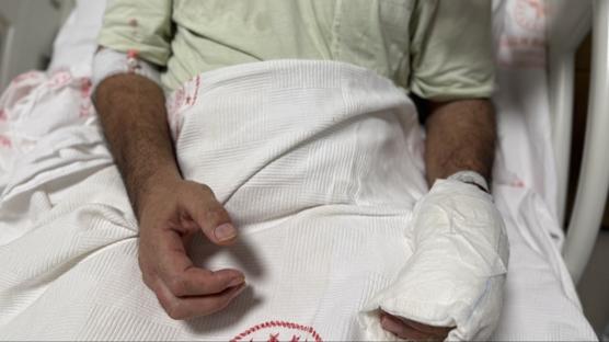 S�cak su torbas� facias�: V�cudunun y�zde 30'u yand�