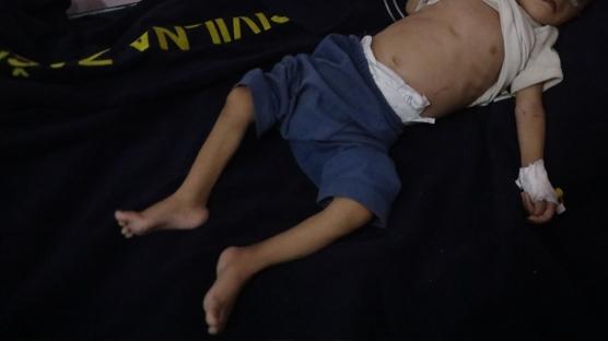 Gazze'de insanlık dondu: 12 günlük bebek hayatını kaybetti