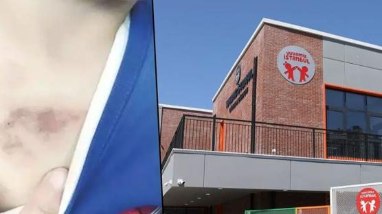 AK Parti'den kre� skandal�na ili�kin a��klama: �BB'nin denetim facias�n� ortaya ��karm��t�r