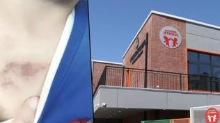 AK Parti'den kre� skandal�na ili�kin a��klama: �BB'nin denetim facias�n� ortaya ��karm��t�r