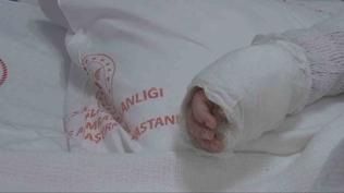 �stanbul'da kaynar su deh�eti: 20 ayl�k bebe�in v�cudunun y�zde 27'si yand�