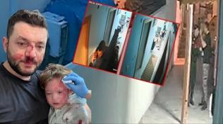 Bebe�in darp edildi�i kavgan�n g�r�nt�leri ortaya ��kt�