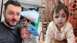 Baba ile bebe�in darbedilmesinde yeni geli�me