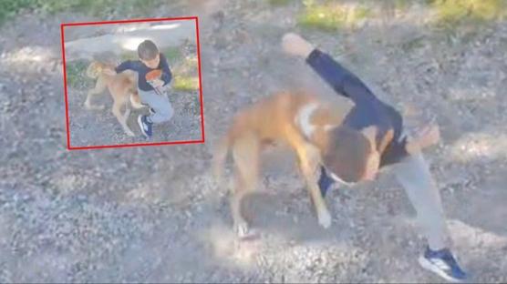 Sahipsiz k�pek sokakta oynarken sald�rd�: 7 ya��ndaki �ocuk hastanelik oldu