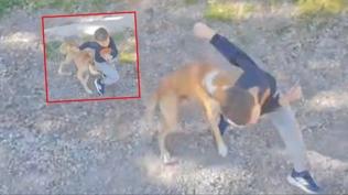 Sahipsiz k�pek sokakta oynarken sald�rd�: 7 ya��ndaki �ocuk hastanelik oldu