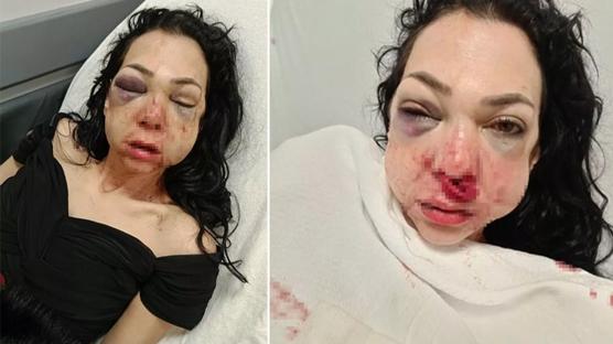 Gözü dönen grup anne ile oğluna saldırdı