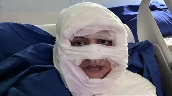 Gen� kad�n� k�skan�l�ktan ate�e veren san�k hakim kar��s�nda