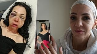 Anneyi �ld�resiye d�venler vukuatl� ��kt�