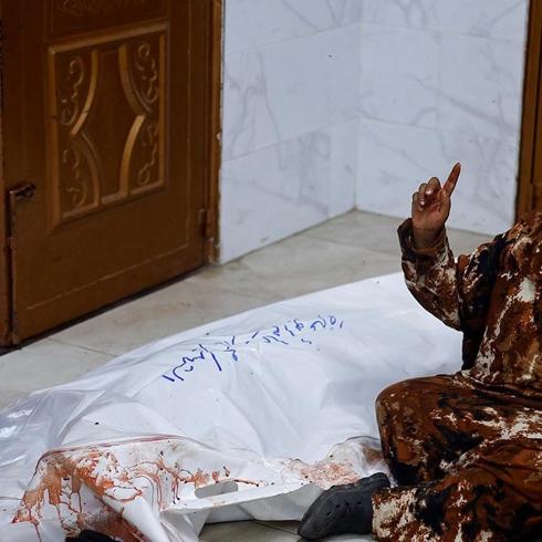 Katil �srail ate�kes dinlemiyor! Gazze'de �ehit say�s� 72 bin 551'e y�kseldi