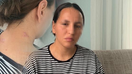 Cani koca 17 yerinden b��aklad�