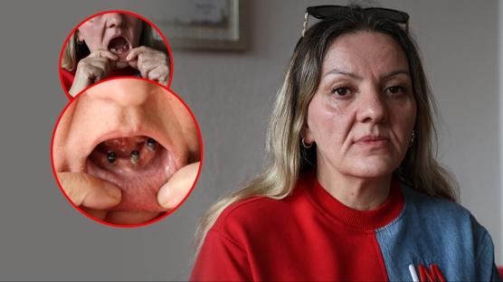 A�r� �ikayetiyle gitti 25 di�inden birden oldu