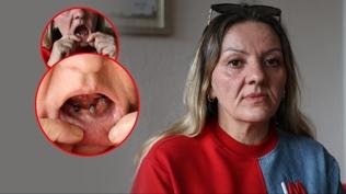 A�r� �ikayetiyle gitti 25 di�inden birden oldu