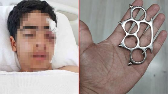 15 ya��ndaki �ocuk bu hale geldi