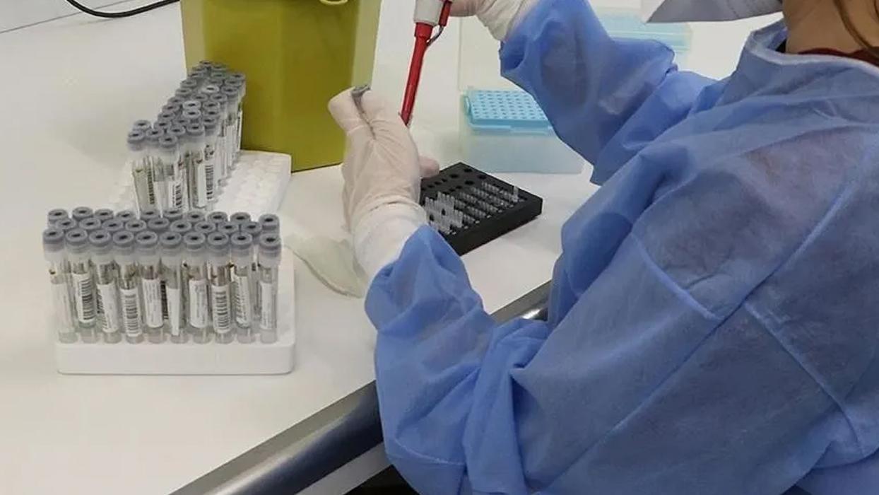 Avrupa ülkesinde salmonella alarmı! Yüzlerce kişi hastalandı