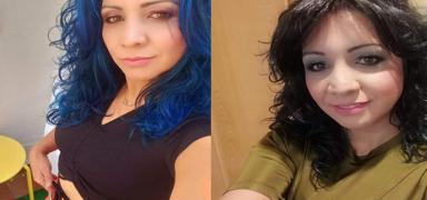 zel hastanede estetik ameliyat kabusu: spanyol kadn hayatn kaybetti