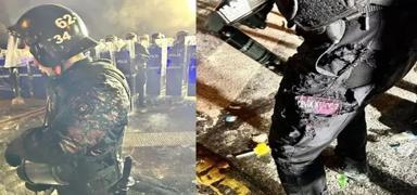 Polise asitli ve baltal� sald�r�