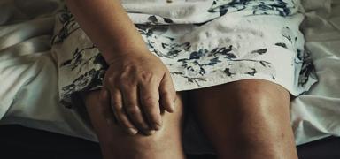 Avustralya'da d�nyada bir ilk: Kan dola��ml� yapay deri dokusu geli�tirildi