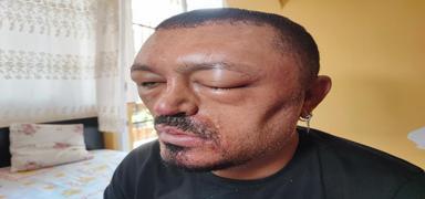 �nternetten ald��� �ampuan hayat�n� karartt�