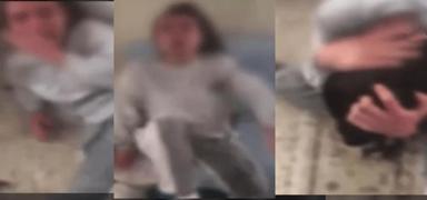 K�z karde�ini kaynar su ile yakt�